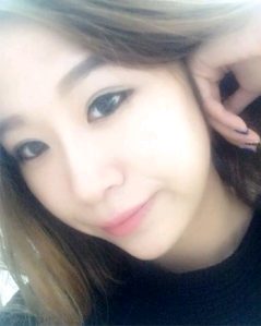 上海時光整形外科醫(yī)院趙克昶做耳軟骨隆鼻案例效果分享