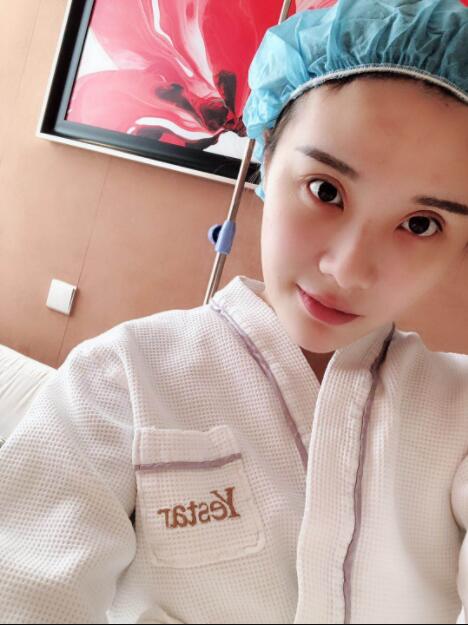 上海藝星醫(yī)療美容醫(yī)院做鼻綜手術(shù)前的樣子