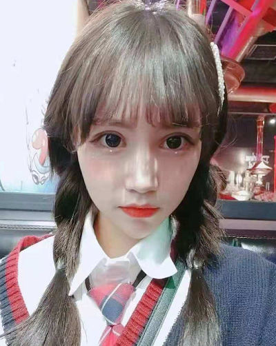 成都美立方(原華博)醫(yī)療美容醫(yī)院做眼部修復(fù)手術(shù)后的三個月 成都美立方(原華博)醫(yī)療美容醫(yī)院做眼部修復(fù)手術(shù)后的三個月